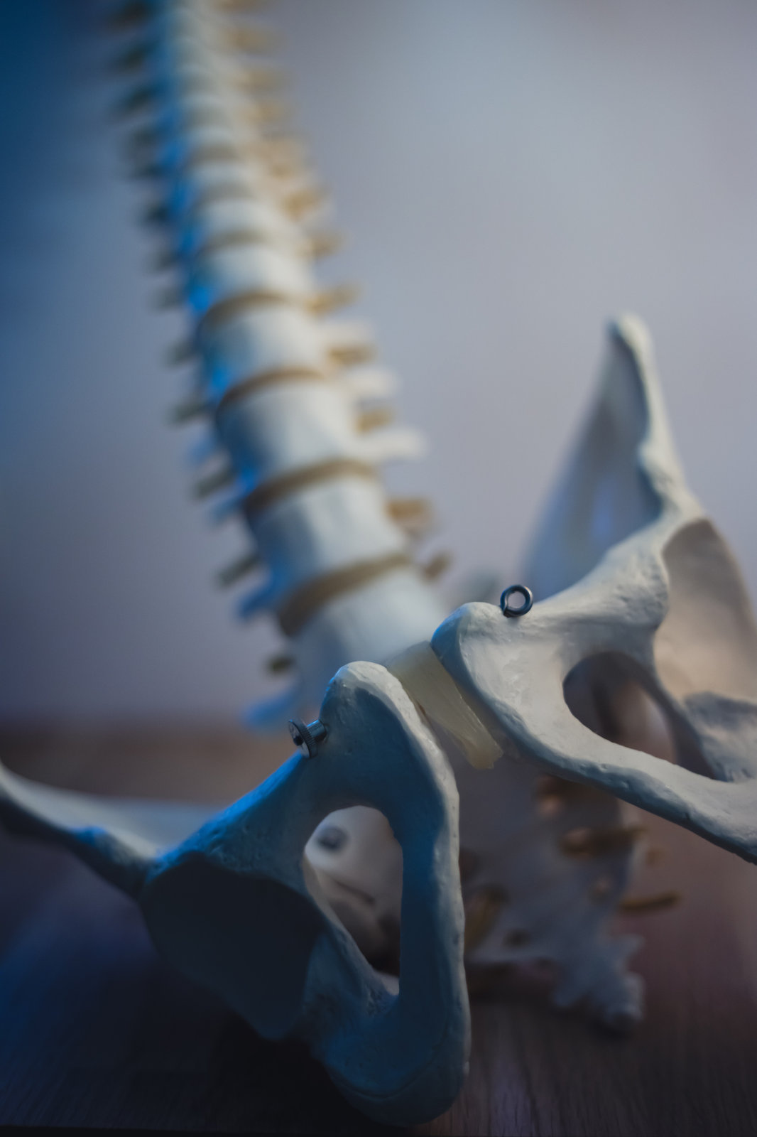 X-ray image of the spine